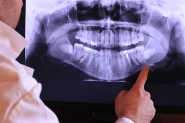 Best Emergency Treatment for Dental Infections or Abscesses in Osseo, WI