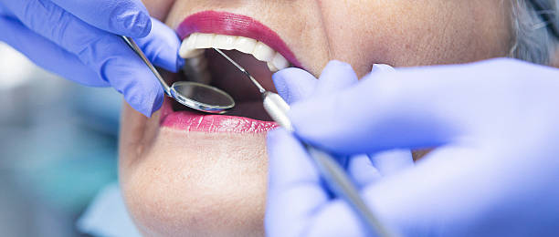 Best Urgent Care for Lost Fillings or Crowns in Osseo, WI